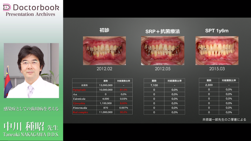 動画紹介］歯周治療をマスターしよう Part2 | Doctorbook